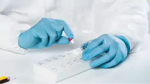 Cancer Antigen 19-9 (CA 19-9): Tumor Marker Test